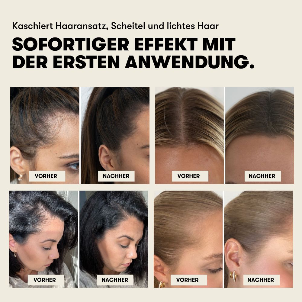 STARTERSET ZUR HAARVERDICHTUNG